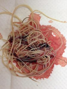 Picture of Actual Heartworms